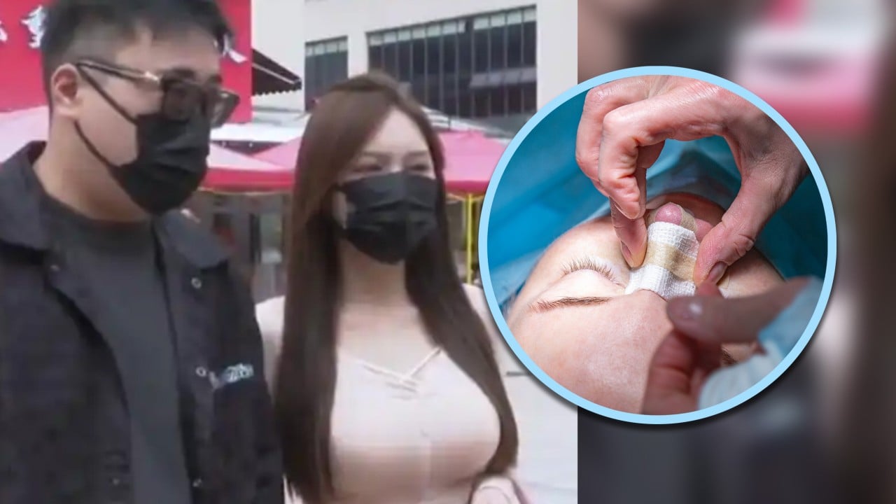 Chinese woman spends US$140,000 entrusted to her by boyfriend on plastic surgery