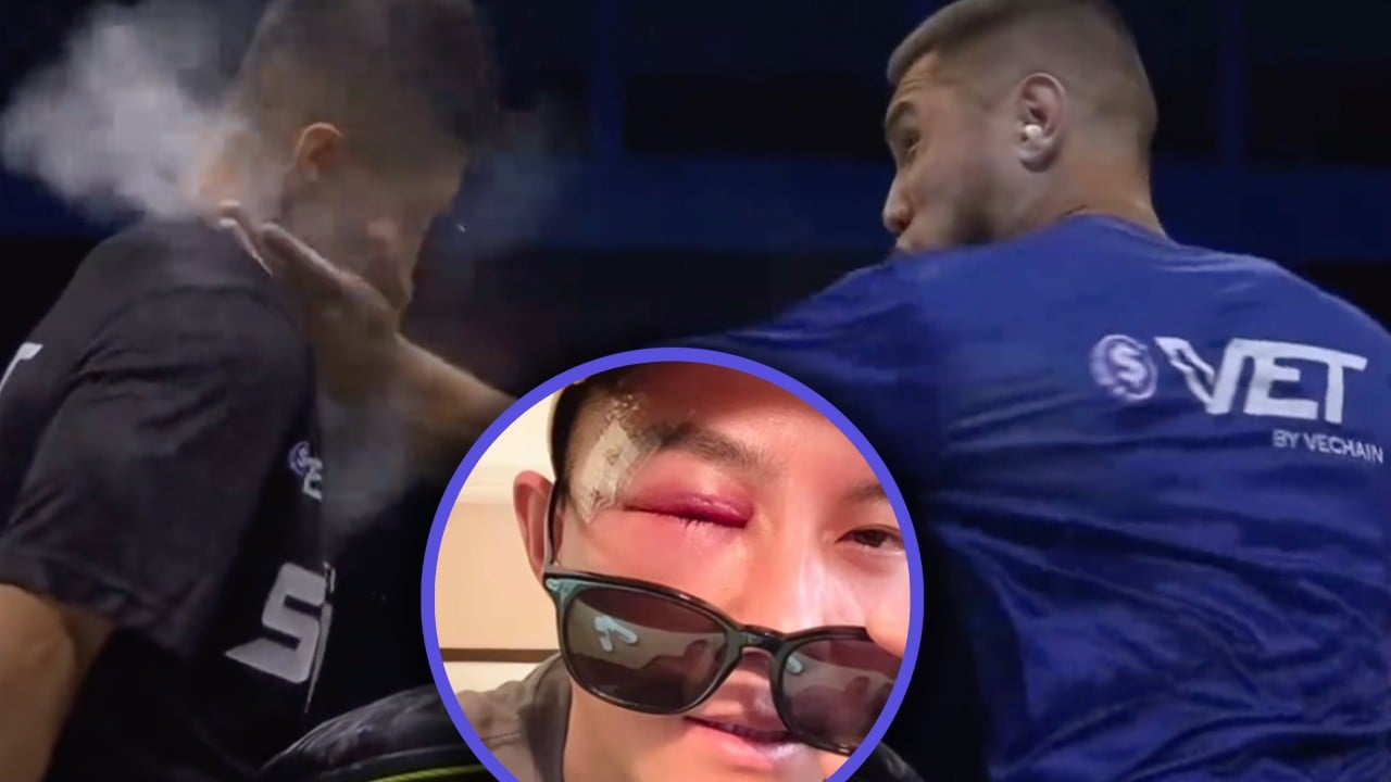 Chinese contestant loses consciousness during ‘Power Slap’ contest, sparks debate