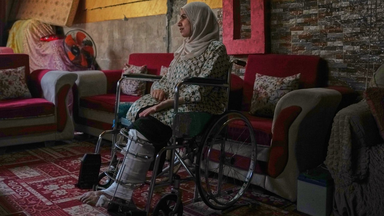 Gaza amputees desperate to walk again amid medical delays: ‘my future is paralysed’