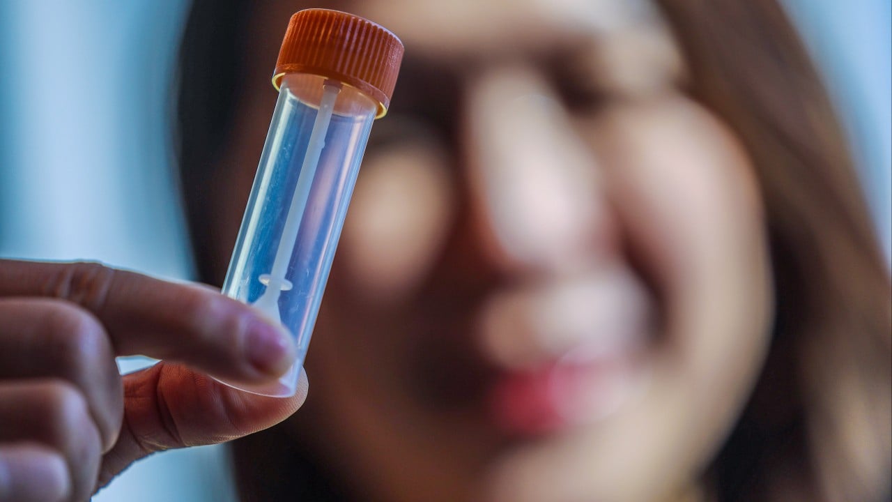 Chinese University of Hong Kong to offer free autism test for 200 young children