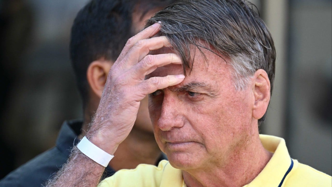 Brazil’s Bolsonaro has brain injury after falling and hitting head in prison