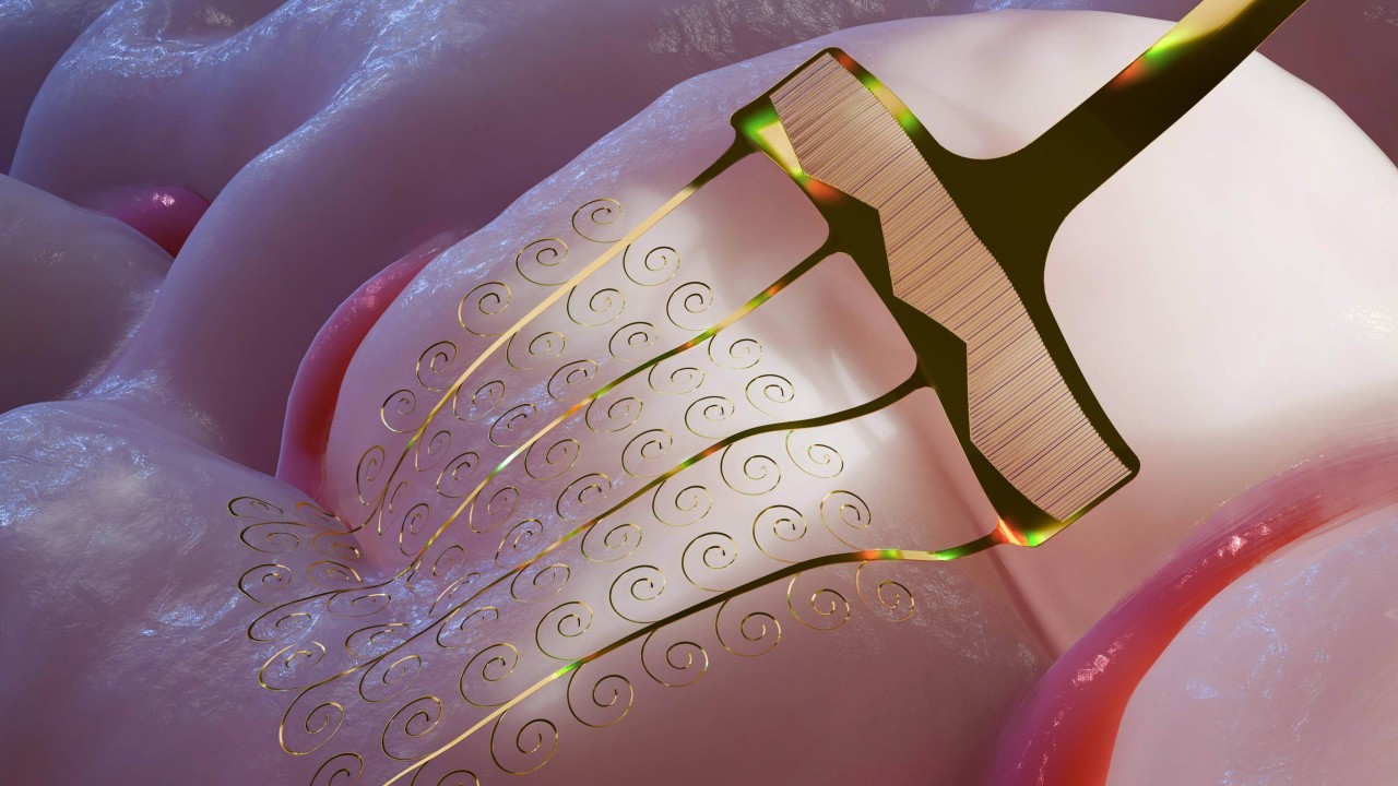 Japanese paper-cutting art inspires flexible brain implants in China