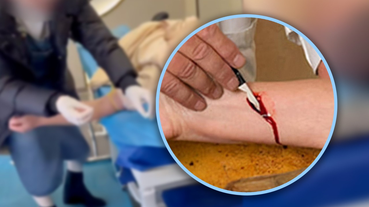 Self-styled China doctors nabbed for performing ‘bloodletting therapy’ to ‘remove’ evil energy