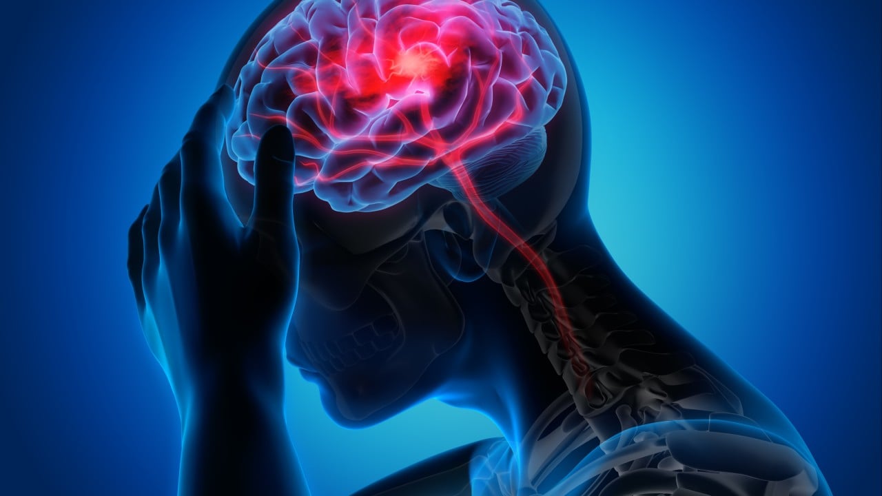 Why China is Betting Big on South Korea New Stroke Treatment