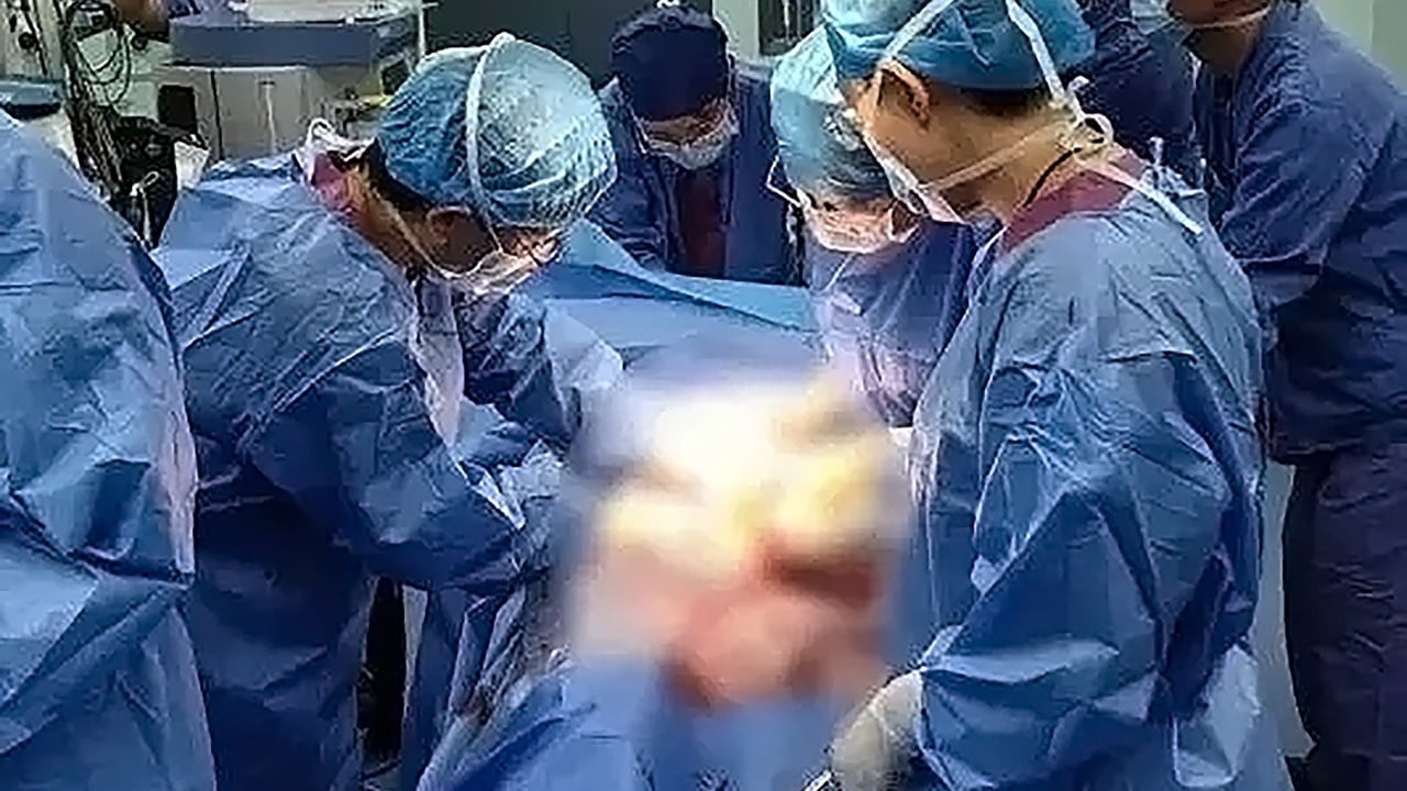 Chinese woman gives up surgery slot to save critically ill mother