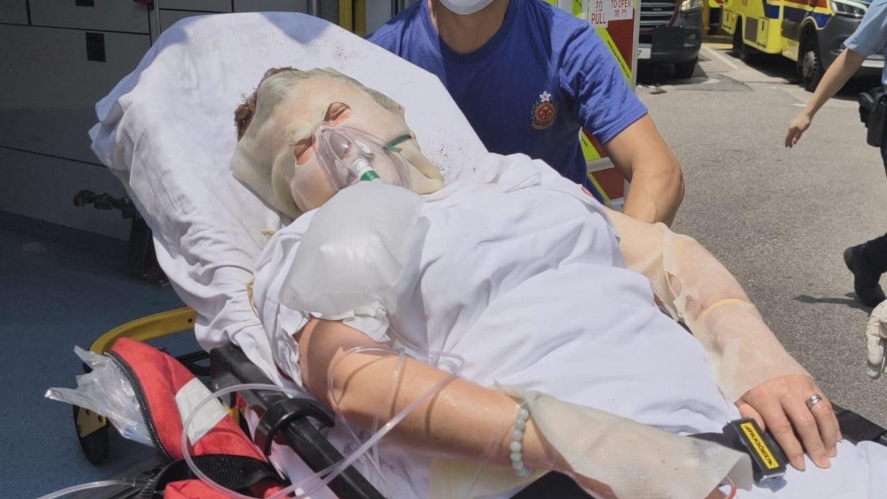 Woman suffers 40% burns in Hong Kong flat explosion caused by ‘gas leak’