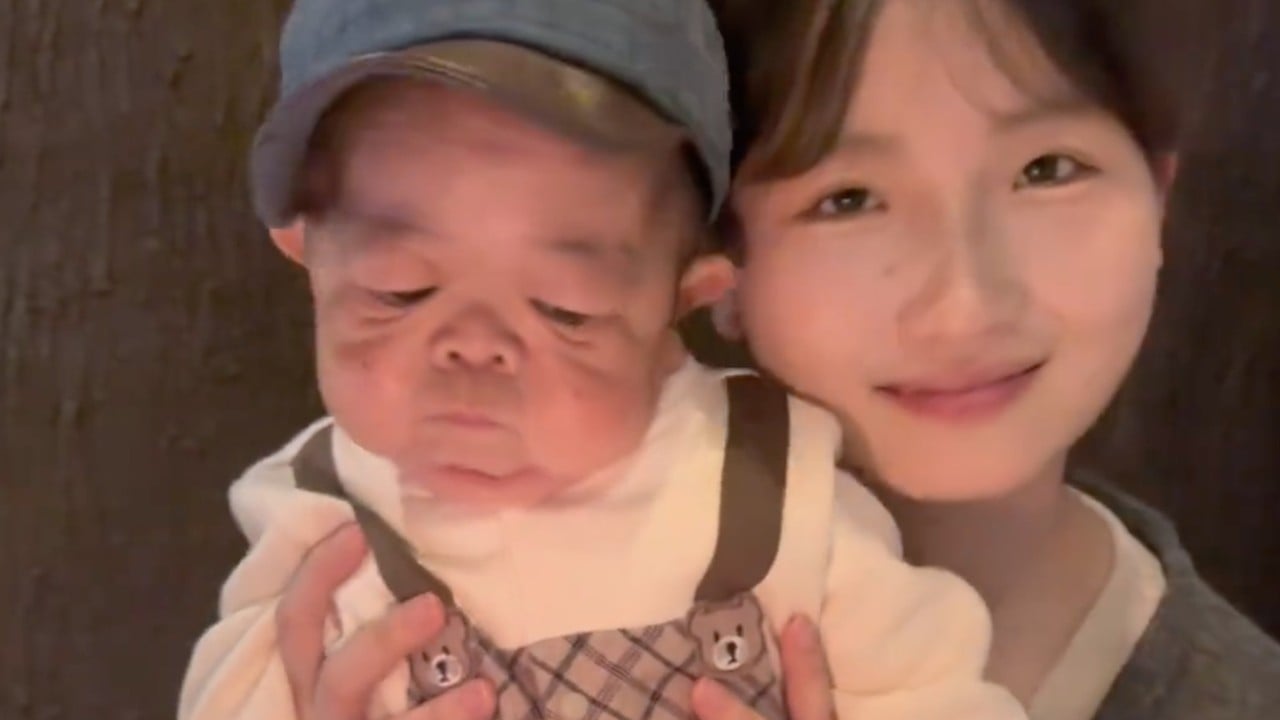 Baby-sized Chinese man, 25, goes viral online after younger sister shares caregiving journey