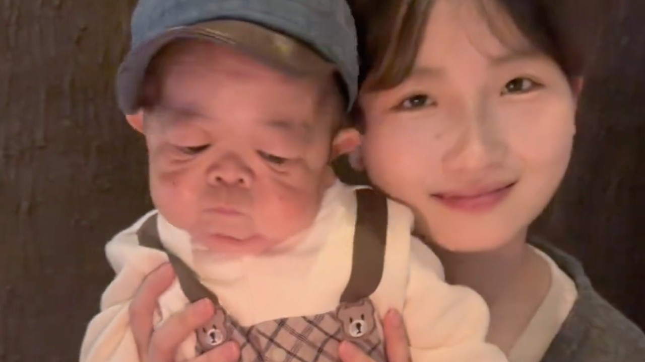 Why This 25 Year Old Man Still Looks Like a Baby and the Viral Story Behind His Care