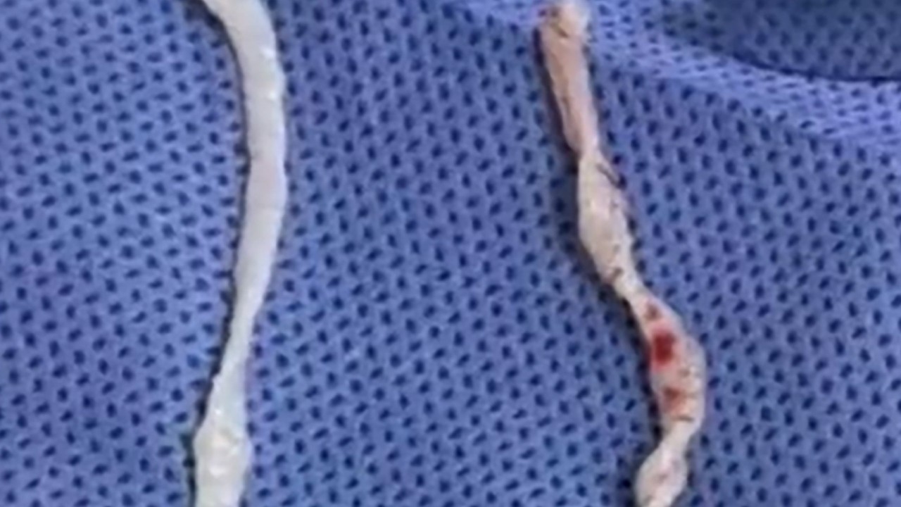 The Live Worms In Your Arm Paranoia Reveals A Deep Failure In Global Public Health Communication