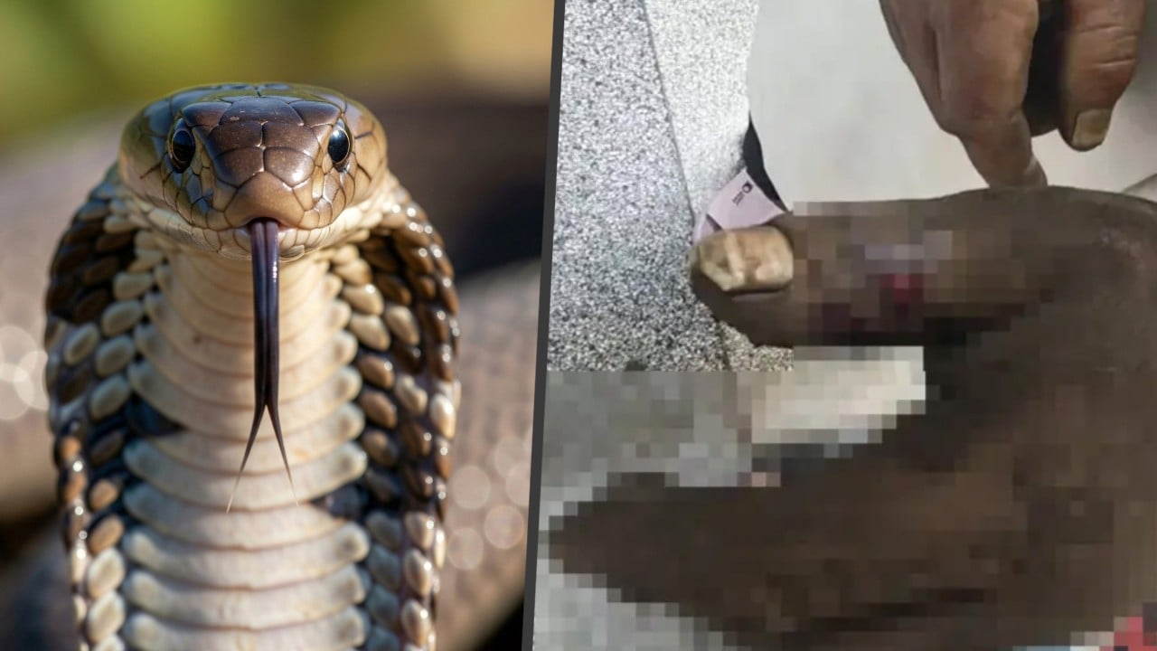 Chinese wife sucks venom from husband’s hand after cobra bite, ending up poisoning herself