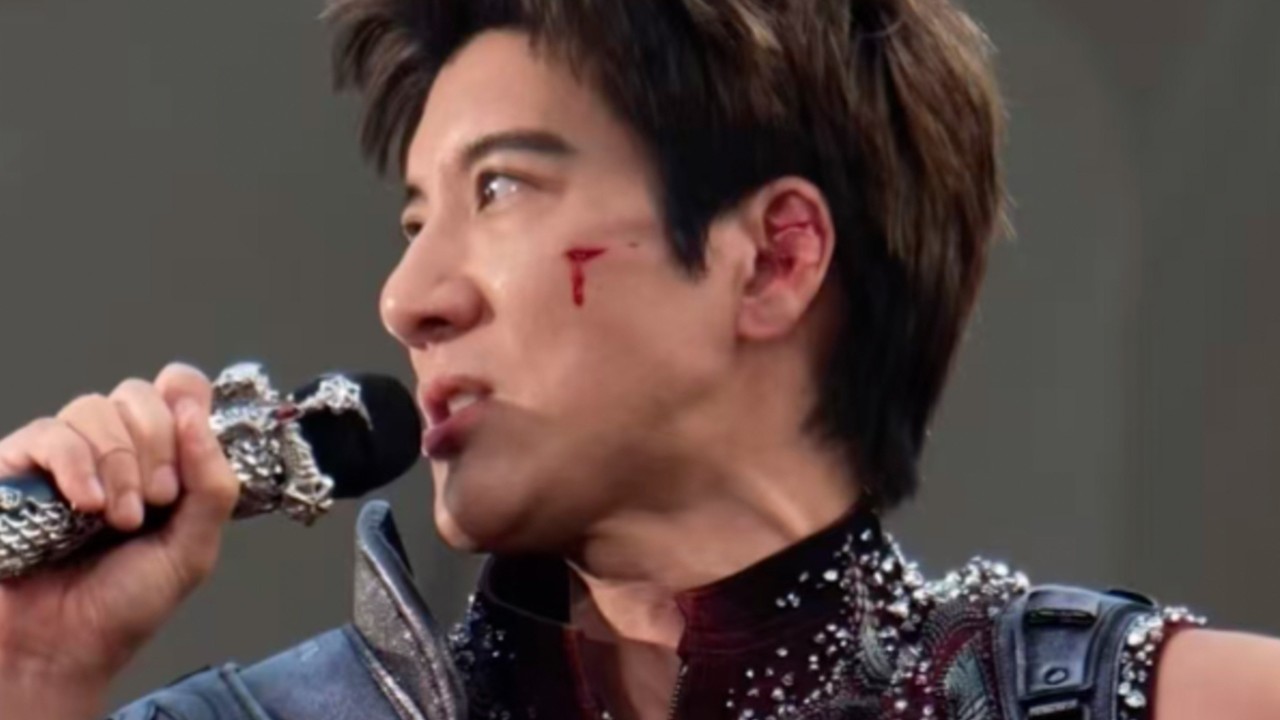 Singer Leehom Wang gets 39 stitches after stage cable trip in China, sparking safety concerns