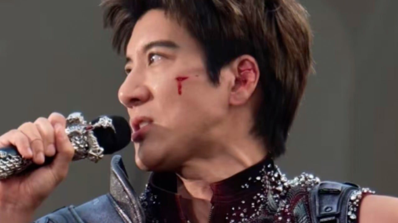 Singer Leehom Wang gets 39 stitches after stage cable trip in China, sparking safety concerns