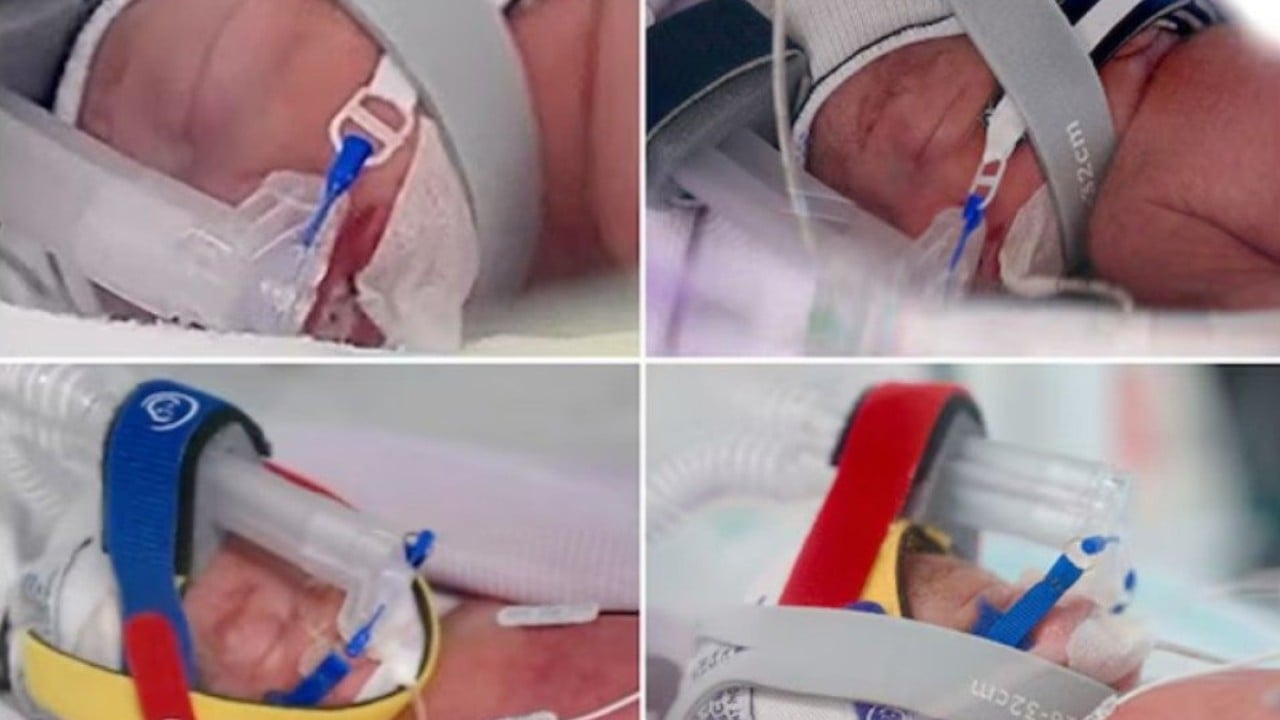 ‘1 in 15 million’: woman in Australia gives birth to identical quadruplet girls