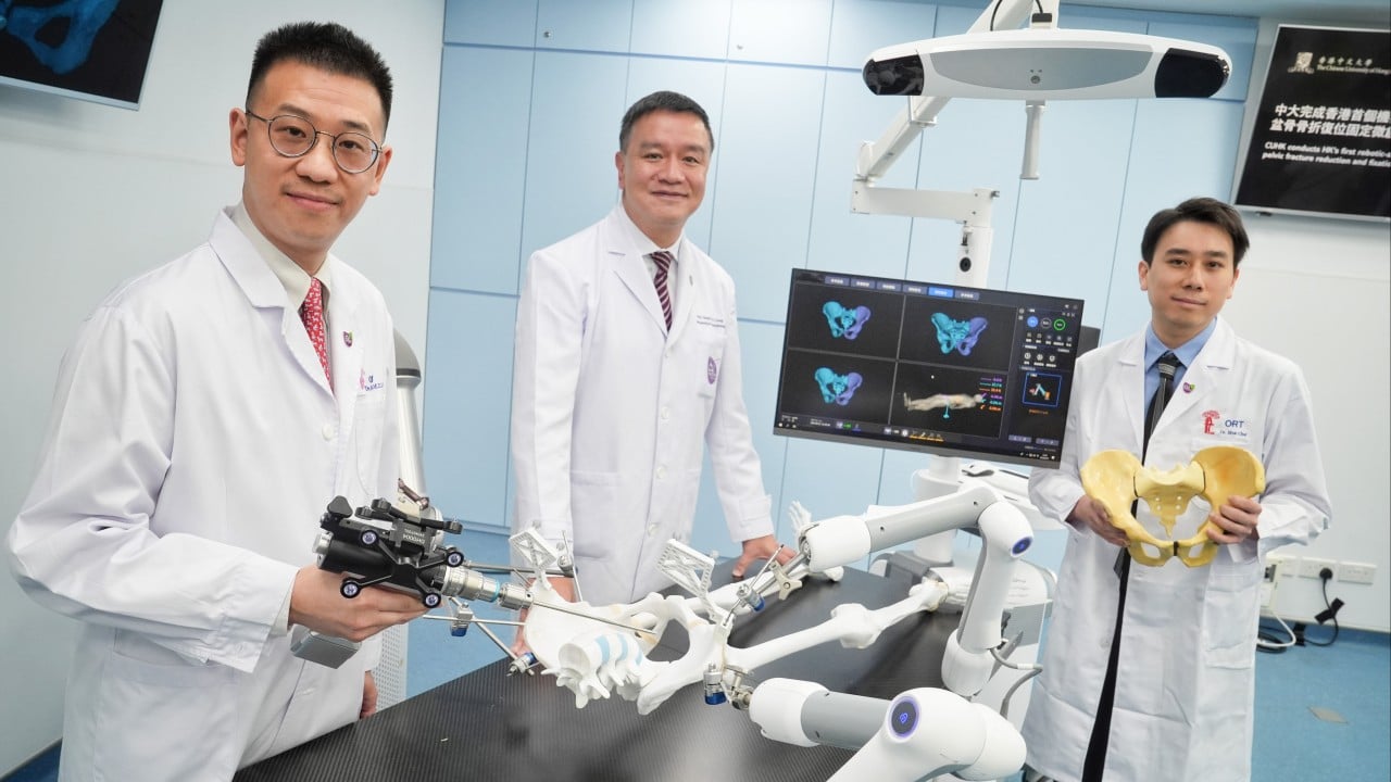CUHK researchers perform Hong Kong’s first robot-assisted pelvic fracture surgery