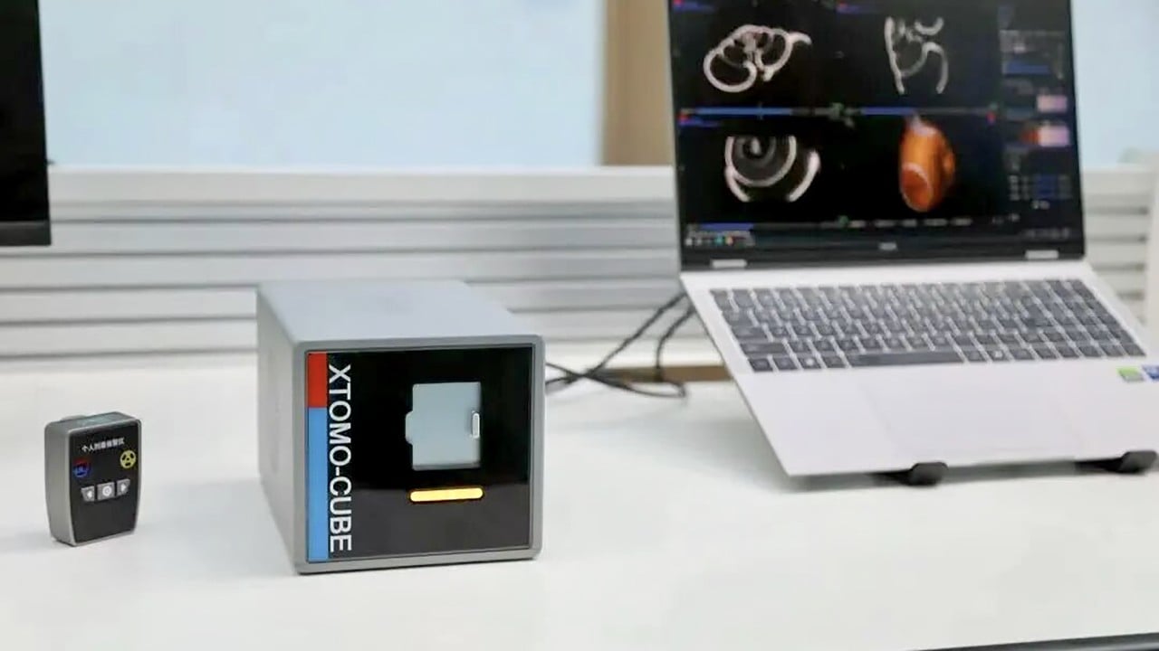 Chinese scientists build world’s smallest CT scanner, weighing just 6kg