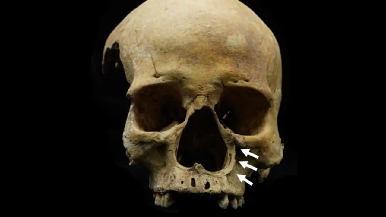 Chinese scientists find first evidence of ancient nose-chopping punishment for cattle thieves
