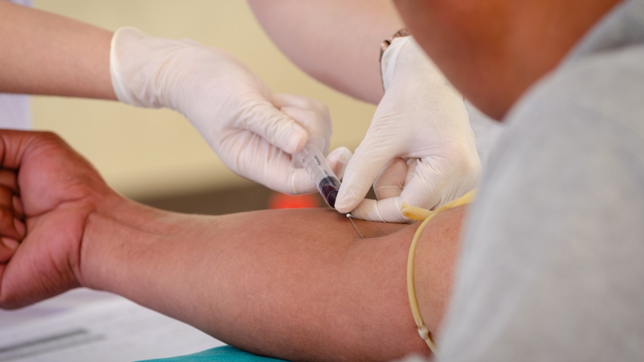 US regulators back multi-cancer blood test – but Hong Kong doctors remain cautious