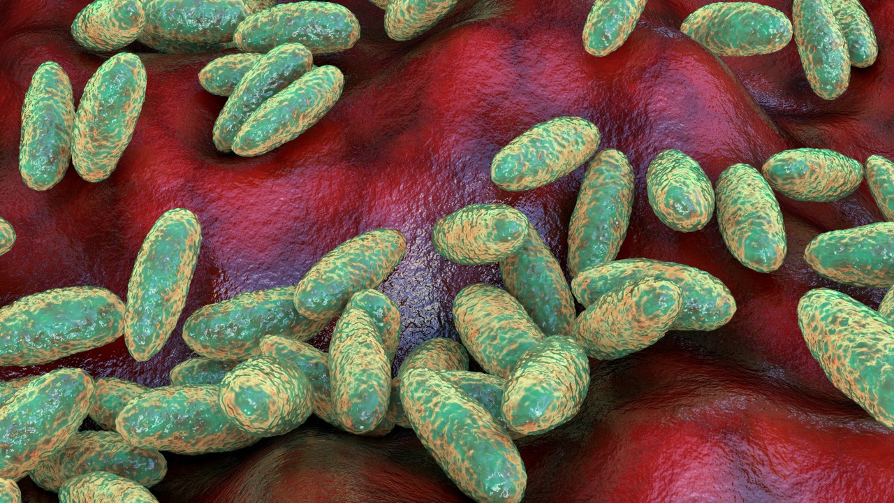 The plague isn’t history. Where it still exists, how it spreads and a cure