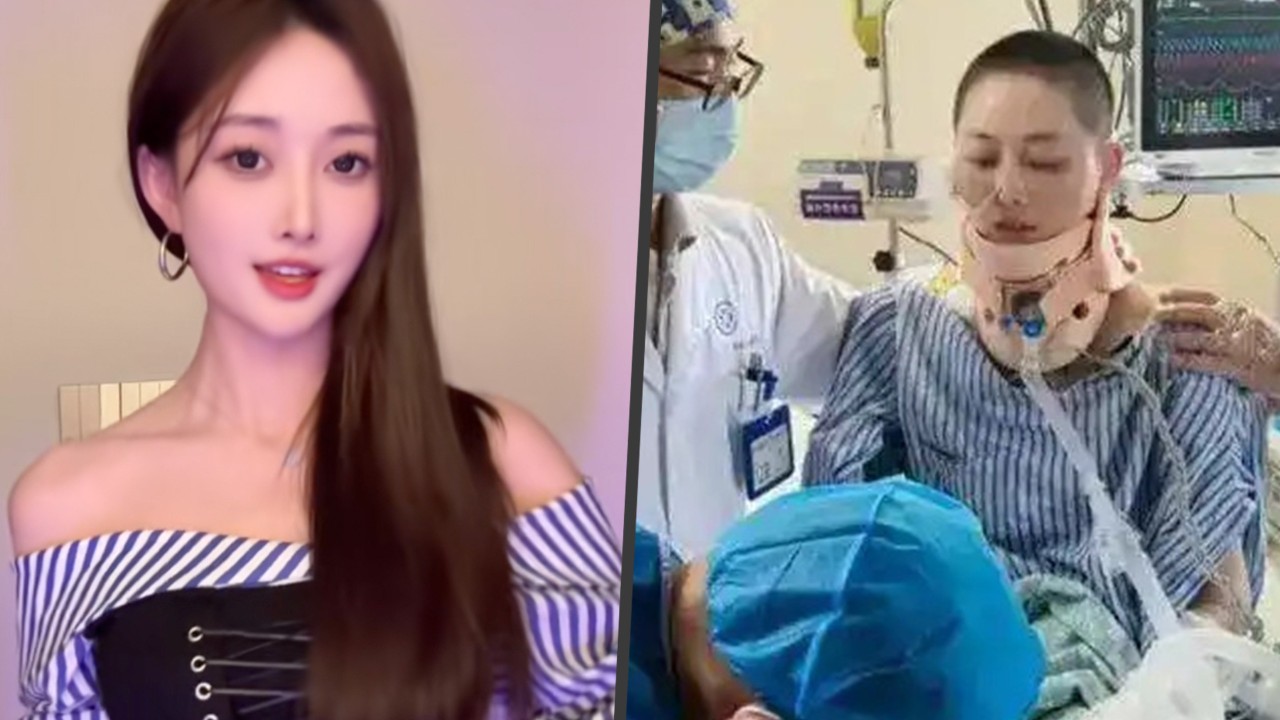 Chinese influencer who survived 35-floor fall returns to social media after near-full recovery