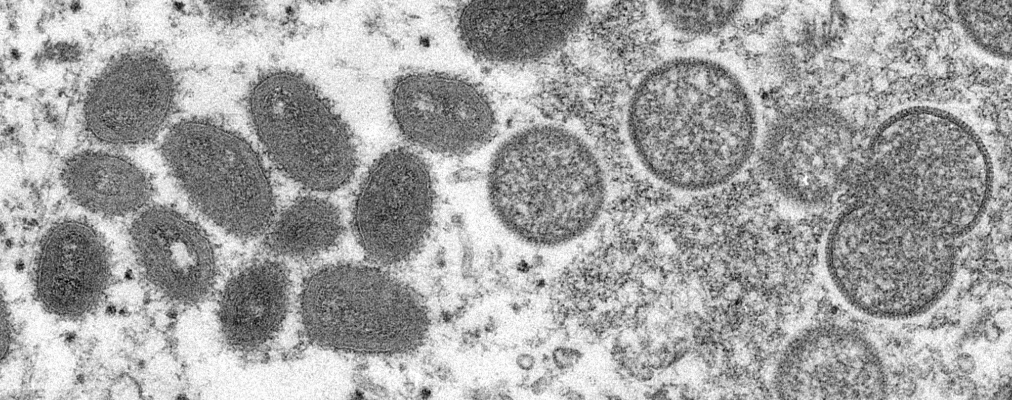 This undated electron microscopic (EM) handout image provided by the US Centers for Disease Control and Prevention depicts a monkeypox virion. Photo: Cynthia S. Goldsmith / Centers for Disease Control and Prevention via AFP