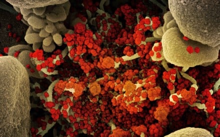 Coronavirus particles are seen in a scanning electron micrograph of a heavily infected cell. Image: NIAID via TNS