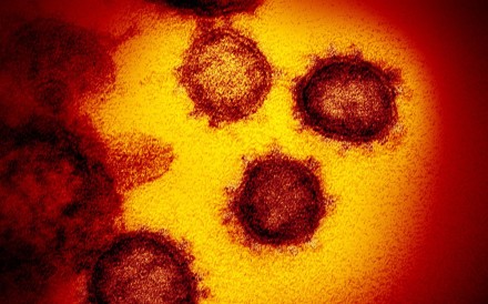 Coronavirus Far More Likely Than Sars To Bond To Human Cells Due To Hiv Like Mutation Scientists Say South China Morning Post
