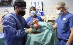 US doctors transplant gene-edited pig heart into human patient in a medical first