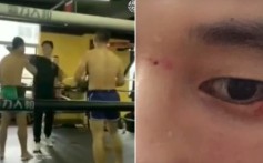 The kung fu ‘master’ gouges Zhang Wensheng’s eye when they go to shake hands. Photos: YouTube/Fight Commentary Breakdowns