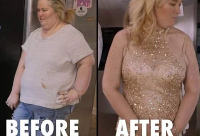 Reality TV’s Mama June lost an enormous amount. of weight after getting gastric sleeve surgery. Photo: @mamajune/Instagram