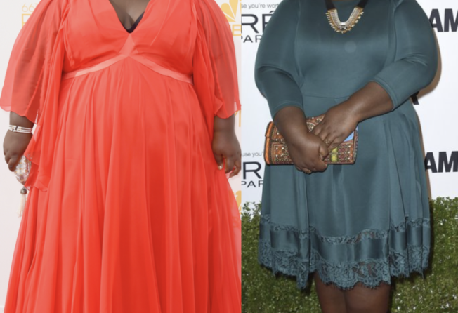 Actress Gabourey Sidibe in 2014 and after her weight loss surgery in 2016. Photo: Getty Images; AP