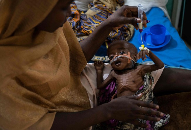 A malnourished child being fed by his mother in Chad; 263 million more people will crash into extreme poverty this year, says Oxfam. Photo: AFP
