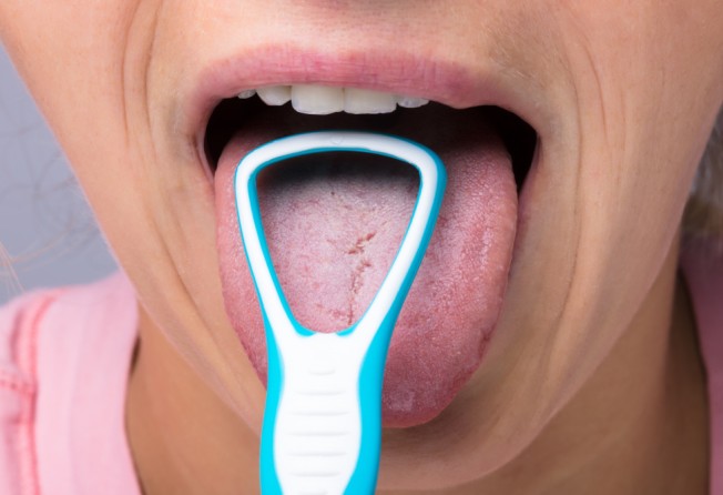 Scraping your tongue removes bacteria and dead cells. Photo: Shutterstock