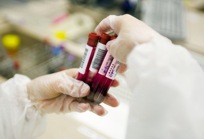 A blood test being trialled by Britain’s National Health Service aims to spot more than 50 kinds of cancers in people without symptoms. Photo: Getty Images