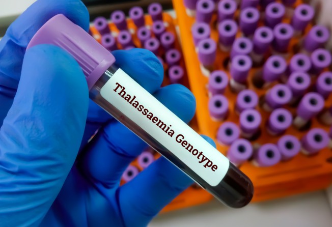 A laboratory worker holds a test tube containing blood for a thalassaemia genotype test. Photo: Shutterstock Images