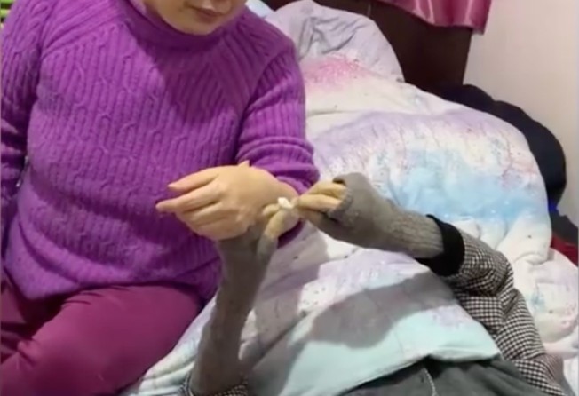 With just hours left to live, 83-year-old Yang Zhenya performs delicate acupuncture on his sick daughter. Photo: Weibo