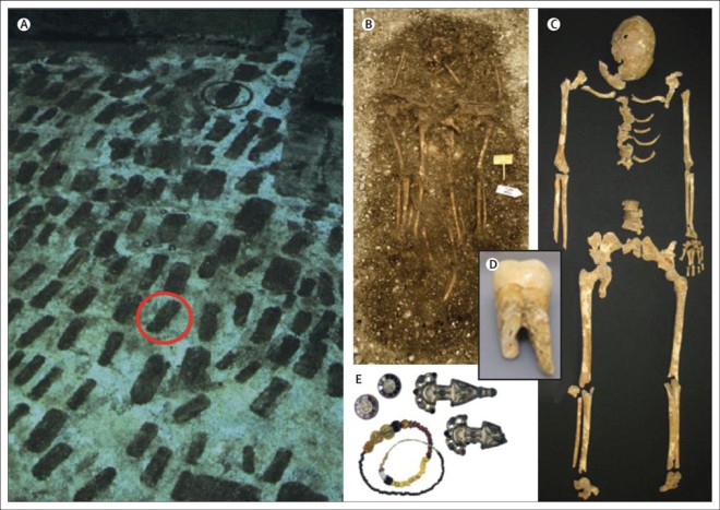 Genetic profile of 6th century plague offers clues to how