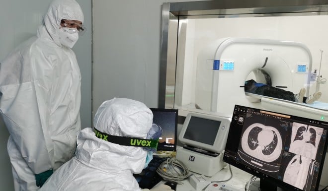 Doctors check the CAT image of a coronavirus patient's lungs at Leishenshan Hospital in Wuhan.