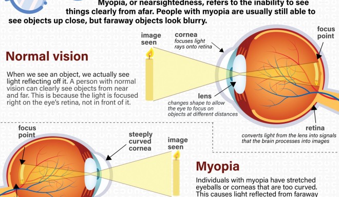 洋書 Collective Myopia /Japanese Organization Collective Myopia in Japanese Organizations: A Transcultural