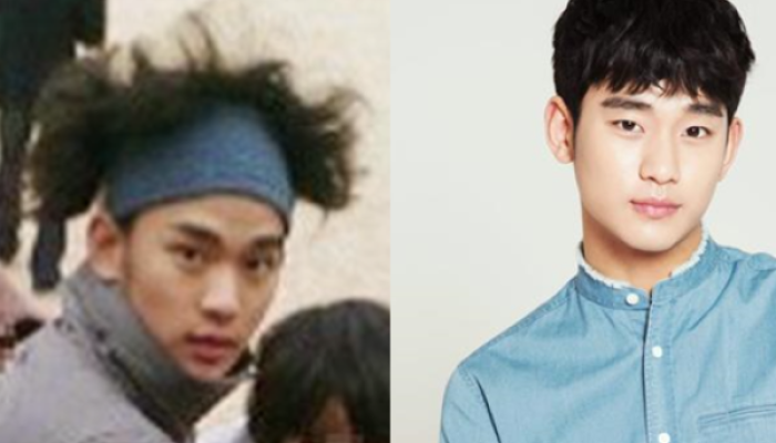 Kim soo discount hyun plastic surgery
