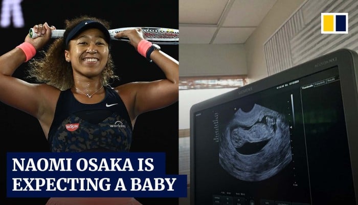 Tennis Star Naomi Osaka Announces Pregnancy Days After Withdrawing From ...