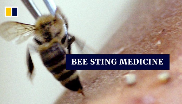 Bee sting as medicine Syrians turn to apitherapy for alternative