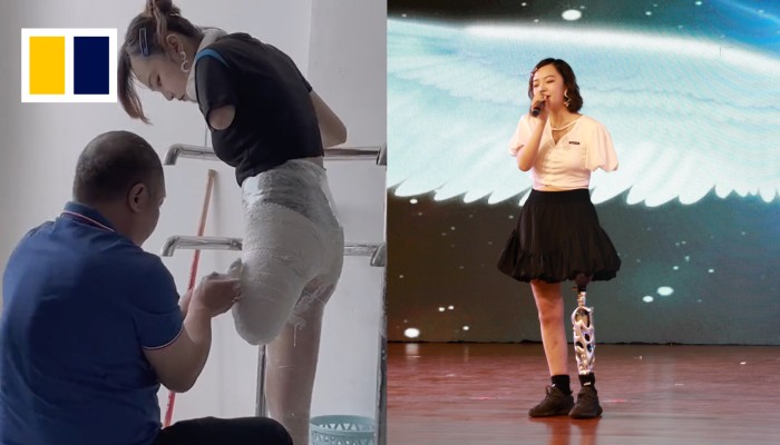 Amputee Becomes Influencer To Inspire People South China Morning Post Amputee Becomes Influencer To Inspire People South China Morning Post