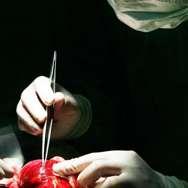 Organ transplant regulations should boost donor numbers, says official