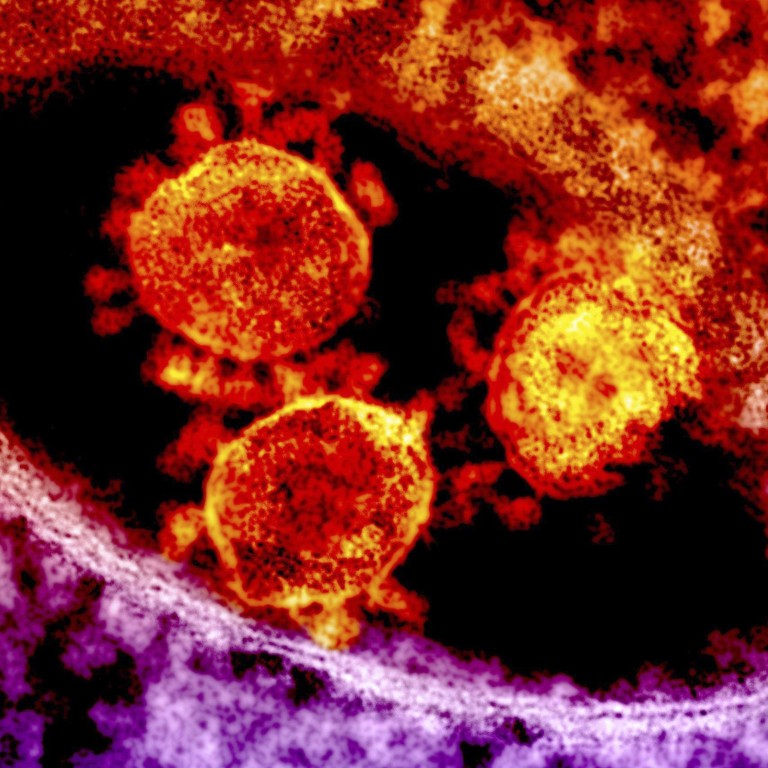 How To Avoid The Mers Virus According To Health Officials South How To Avoid The Mers Virus According To Health Officials South
