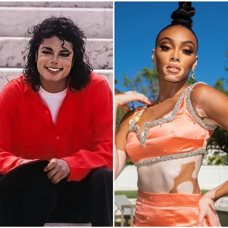 From left, Michael Jackson, model Winnie Harlow and Indian billionaire Gautam Singhania, who are among the celebrities with vitiligo, a condition that results in a whitening of the skin. Photos: @__m.j.the.king__, @winnieharlow, @gautamsinghania99/Instagram