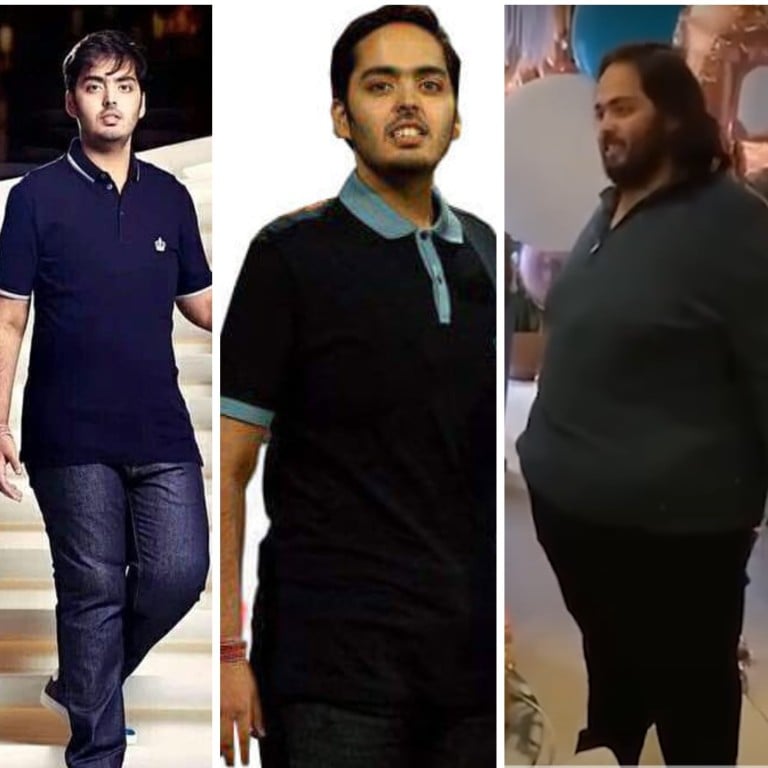 The Highs And Lows Of Anant Ambani’s Incredible Weight Journey: Mukesh ...