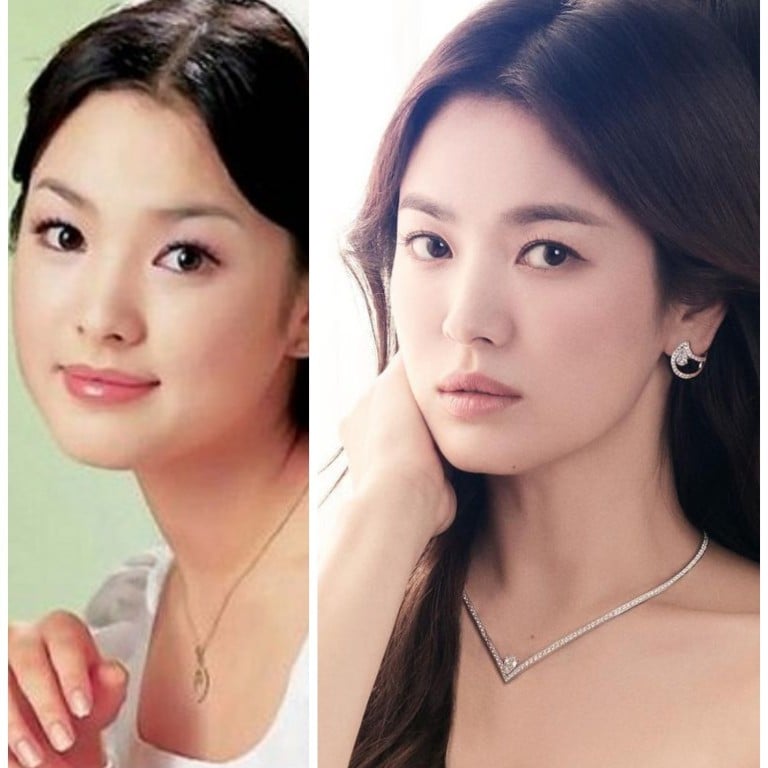 Son ye deals jin plastic surgery