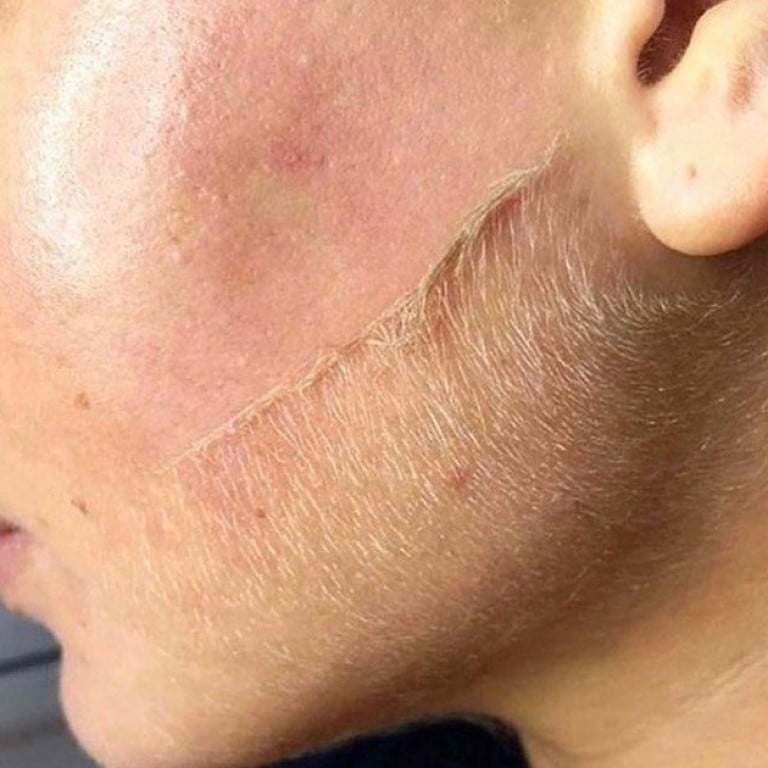 Dermaplaning: the face shaving trend on TikTok women are no longer shy to  talk about | South China Morning Post