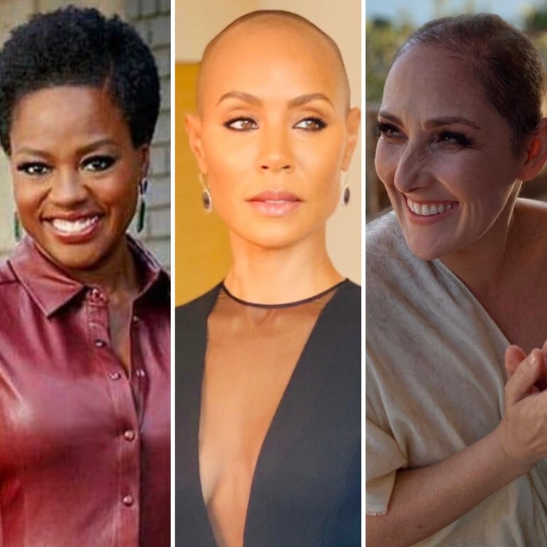 10 celebrities who suffer from alopecia: Jada Pinkett Smith's hair loss is  in the spotlight after Will Smith's slapgate, but Tyra Banks, Selma Blair  and Naomi Campbell experienced it too | South
