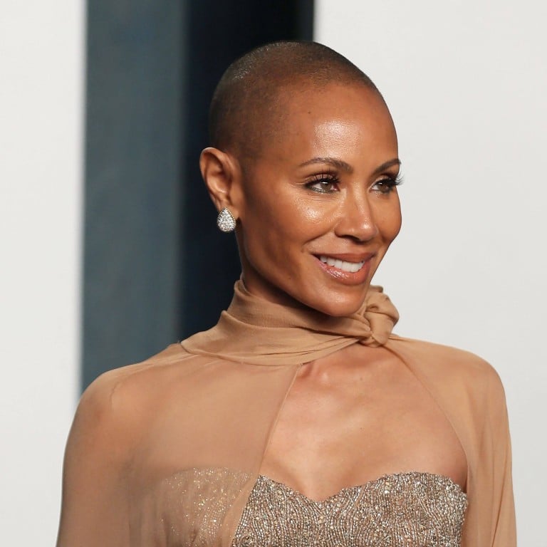 Jada Pinkett Smith’s alopecia is in the spotlight after Will Smith’s Oscars slap, but what is the hair loss condition exactly? Photo: Reuters